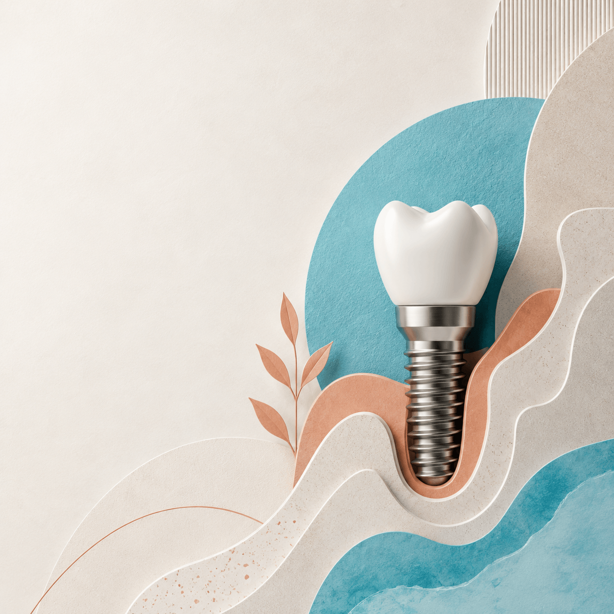 ¿Cuánto tarda un implante dental? Fases y tiempos del tratamiento